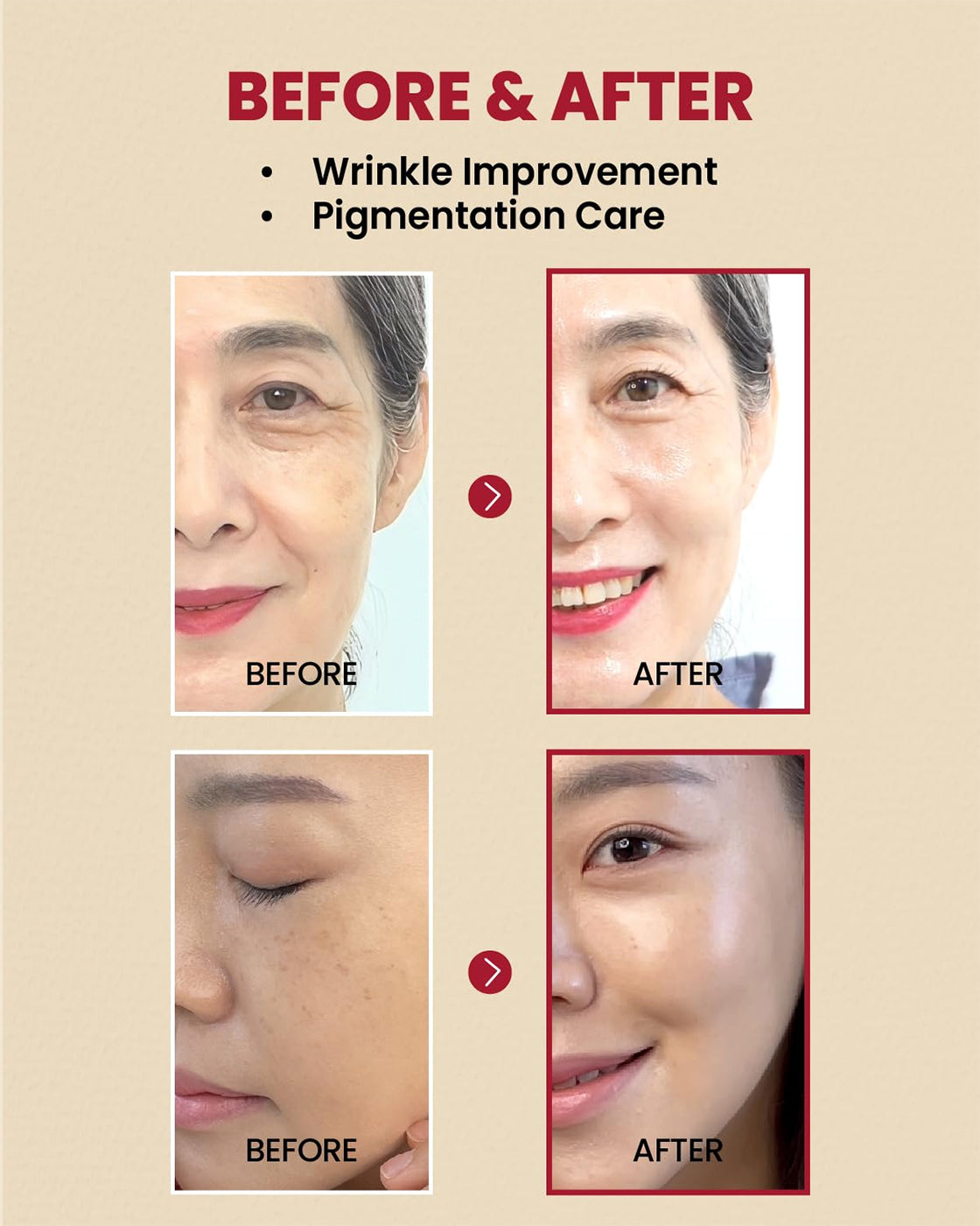 Zwei Frauen vor und nach der Anwendung von K-Secret Serum: Retinales Liposom 2 % + schwarzer Ginseng mit glatterer und klarerer Haut.